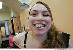 A new meaning for USDM grill...-ba_goldteeth131pg.jpeg