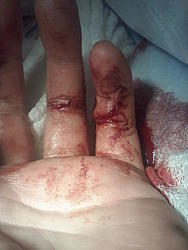 ryball's &quot;brucelee emergency room carnage&quot; picture thread NSFW-1105092312.jpg