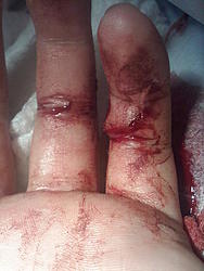 ryball's &quot;brucelee emergency room carnage&quot; picture thread NSFW-1105092312a.jpg