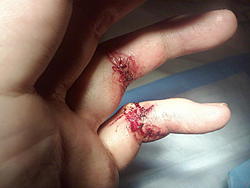 ryball's &quot;brucelee emergency room carnage&quot; picture thread NSFW-1106090055.jpg