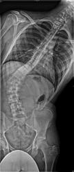 Spinal Surgery on the 28th.-john2-2.jpg