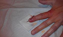 Gnarly injuries?-sew.jpg