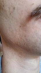 Humpty Dumpty...-forumrunner_20140319_173130.jpg
